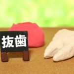 抜かないという選択肢もある!親知らずの抜歯について詳しく解説