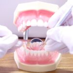 口臭がなくなるメリットも!スケーリングとクリーニングについて